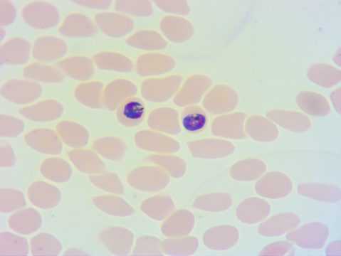 An image of Plasmodium falciparum parasites in two blood cells. There is a purple blob in each red blood cell. Photo courtesy of Maria Belen Cassera.